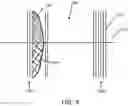 Fig. 06 - EMBOLISATION SYSTEM FOR PROMOTING CLOT FORMATION