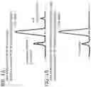 Fig. 02 - DNA AMPLIFICATION METHOD, DNA AMPLIFICATION KIT, AND PROFILING/DIAGNOSIS METHOD