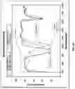 Fig. 07 - Optical element comprising mix of NIR dyes for broader NIR cut and better aesthetic