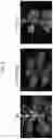 Fig. 06 - METHOD FOR SUPPRESSING METHYLATION OF TARGET DNA IN PLANT