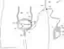 Fig. 01 - ARTIFICIAL BLADDER SYSTEM