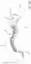 Fig. 04 - Multiple spinal surgical pathways systems and methods