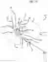 Fig. 08 - Multiple spinal surgical pathways systems and methods