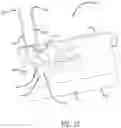 Fig. 10 - Multiple spinal surgical pathways systems and methods