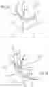 Fig. 12 - Multiple spinal surgical pathways systems and methods