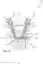 Fig. 16 - Multiple spinal surgical pathways systems and methods