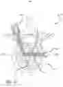 Fig. 17 - Multiple spinal surgical pathways systems and methods