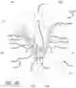 Fig. 31 - Multiple spinal surgical pathways systems and methods