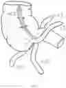 Fig. 02 - STAPLER APPARATUS AND METHODS FOR USE
