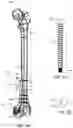 Fig. 14 - BONE FIXATION DEVICES, SYSTEMS, AND METHODS