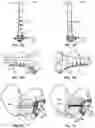 Fig. 15 - BONE FIXATION DEVICES, SYSTEMS, AND METHODS