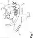 Fig. 02 - Configurable Replacement Mechanism for Leadless Pacemaker System