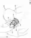 Fig. 04 - REPLACEMENT HEART VALVE IMPLANT