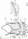 Fig. 05 - REPLACEMENT HEART VALVE IMPLANT