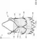 Fig. 06 - REPLACEMENT HEART VALVE IMPLANT