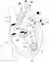 Fig. 01 - CARDIOVASCULAR DEVICE AND KIT FOR THE REDUCTION OF A CARDIAC CAVITY