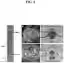 Fig. 07 - SHATTERPROOF GENES AND MUTATIONS