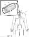 Fig. 02 - COMPOSITE POSITIVE AND NEGATIVE POISSON'S RATIO MATERIALS FOR MEDICAL DEVICES