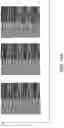 Fig. 22 - ACOUSTICALLY-DRIVEN QUANTUM SPIN SENSOR