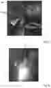 Fig. 10 - ASSEMBLY COMPRISING AN OCT DEVICE FOR ASCERTAINING A 3D RECONSTRUCTION OF AN OBJECT REGION VOLUME, COMPUTER PROGRAM, AND COMPUTER-IMPLEMENTED METHOD FOR SAME