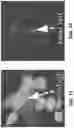 Fig. 16 - Automated system for high-throughput microinjection of adherent cells