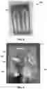 Fig. 09 - Light weight thermal runaway and explosion resistant aerospace battery