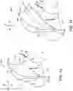 Fig. 09 - Turbine engine with shockwave attenuation