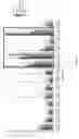 Fig. 03 - Modulation Of Endoplasmic Reticulum Aminopeptidase 2 (ERAP2)-Mediated Immune Response