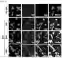 Fig. 04 - METHOD OF OVEREXPRESSING TARGET GENE USING ELECTROMAGNETIC WAVE-REACTIVE PROMOTER
