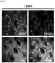 Fig. 06 - METHOD OF OVEREXPRESSING TARGET GENE USING ELECTROMAGNETIC WAVE-REACTIVE PROMOTER