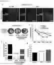 Fig. 13 - METHOD OF OVEREXPRESSING TARGET GENE USING ELECTROMAGNETIC WAVE-REACTIVE PROMOTER