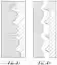 Fig. 04 - DENTAL IMPLANT WITH IMPROVED STABILIZATION THREAD FORM AND CUTTING ELEMENTS