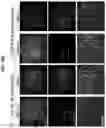 Fig. 34 - TARGETING PAR1 AND PAR2 TO REGULATE LIPID AND CHOLESTEROL ABUNDANCE