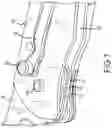 Fig. 06 - Knife with replaceable blade