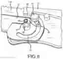 Fig. 07 - Knife with replaceable blade