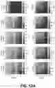Fig. 09 - Ultrasound transducers for constructive shear wave interference and related methods and systems