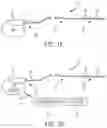 Fig. 02 - Medical device lead conductor to terminal interface