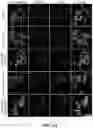 Fig. 09 - IRON OXIDE NANOPARTICLE FOR TARGETED CHEMO-IMMUNOTHERAPY