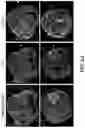 Fig. 22 - IRON OXIDE NANOPARTICLE FOR TARGETED CHEMO-IMMUNOTHERAPY
