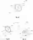 Fig. 12 - CIRCUMFERENTIAL ABLATION DEVICES AND METHODS