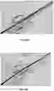 Fig. 35 - CIRCUMFERENTIAL ABLATION DEVICES AND METHODS