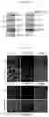 Fig. 72 - COMBINATION THERAPY FOR CANCER