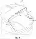 Fig. 02 - Drag reduction spoiler