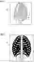 Fig. 02 - METHOD FOR PROVIDING MEDICAL IMAGING DECISION SUPPORT DATA AND METHOD FOR PROVIDING GROUND TRUTH IN 2D IMAGE SPACE