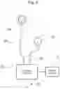 Fig. 03 - Electric and Magnetic Neuromodulation