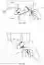 Fig. 07 - ANESTHESIA SAFETY NEEDLE DEVICE