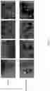 Fig. 02 - Stimulation of Human Meibomian Gland Function