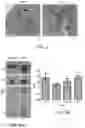 Fig. 07 - Stimulation of Human Meibomian Gland Function