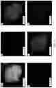 Fig. 04 - Nickel nanoparticle functionalized amine-modified fibrous hierarchical zeolite and method of making the same