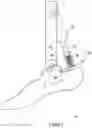 Fig. 03 - PROSTHETIC FOOT ASSEMBLY
